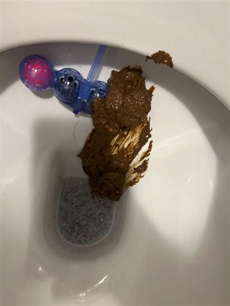 Creamy diarrhea .
